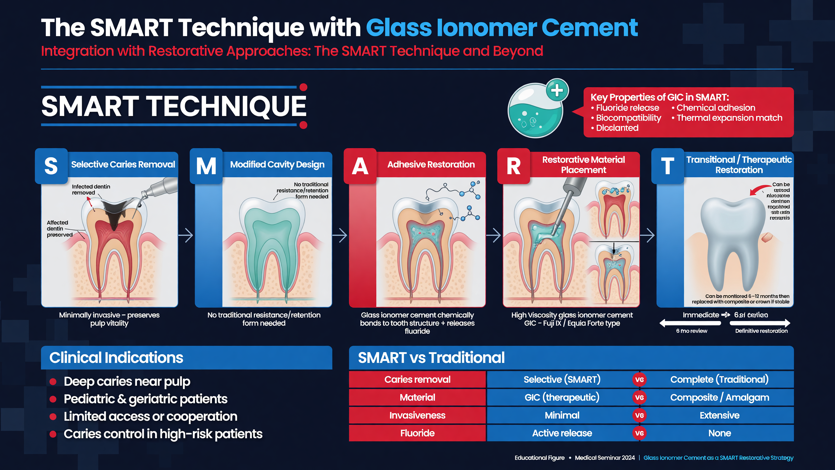 Diagram illustrating the SMART technique with glass ionomer cement.