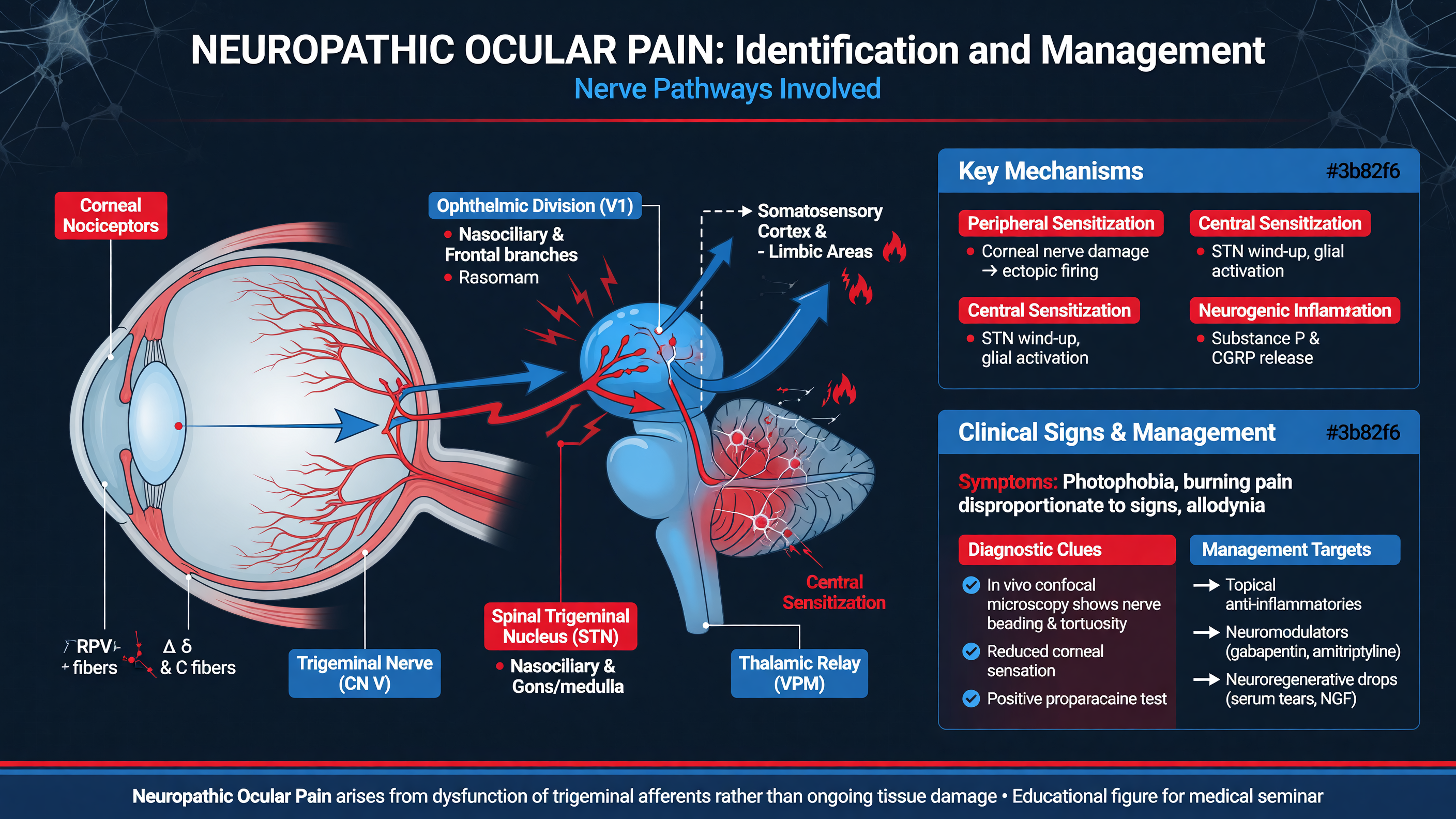 Illustration of nerve pathways involved in neuropathic ocular pain