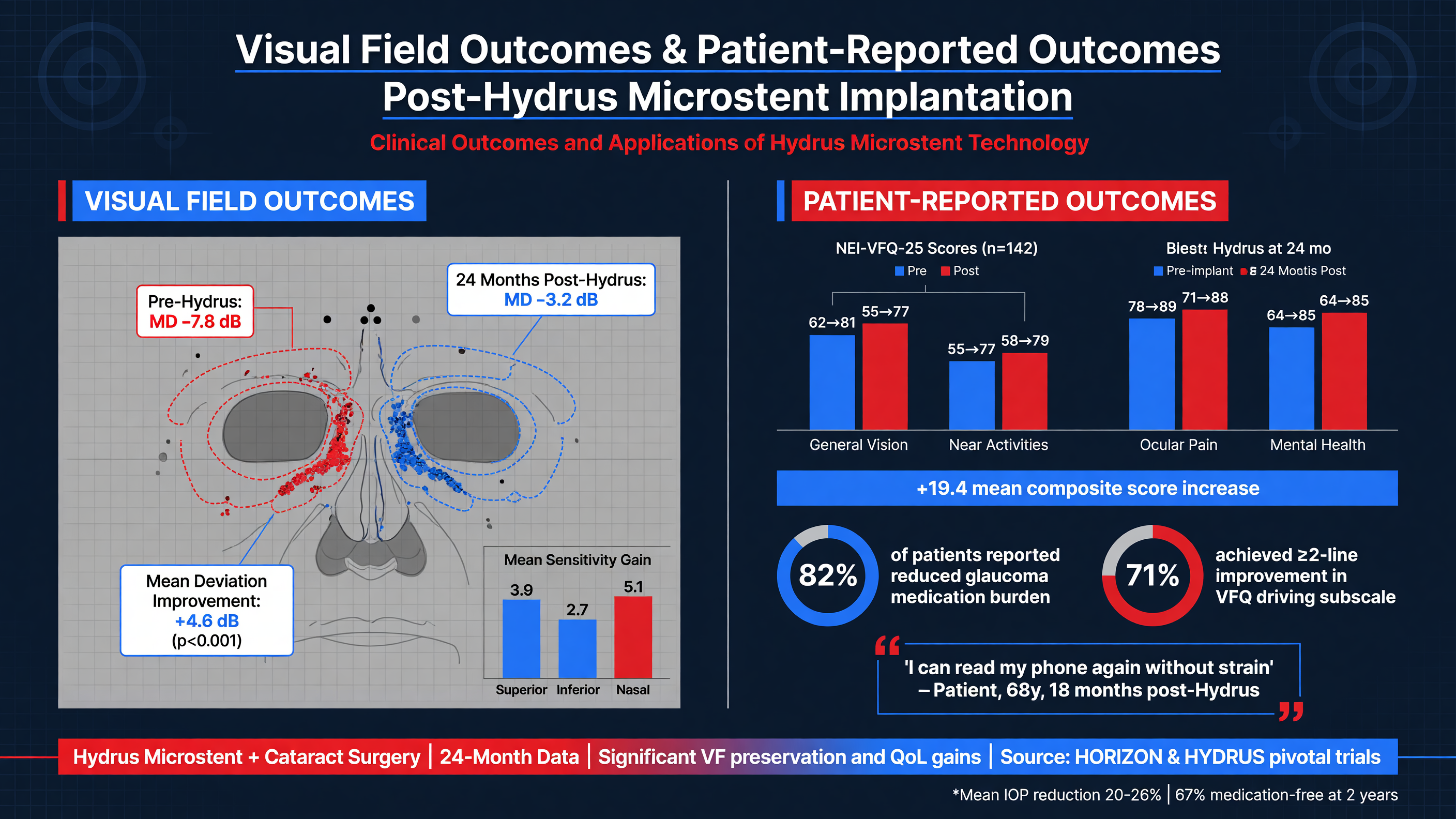 Visual field outcomes and patient reported outcomes post-Hydrus implantation.