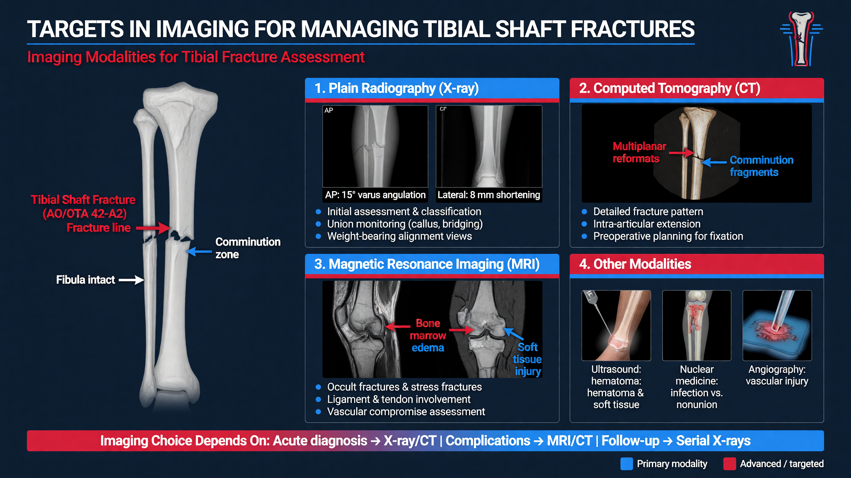 Diagram of imaging modalities used in tibial fracture
