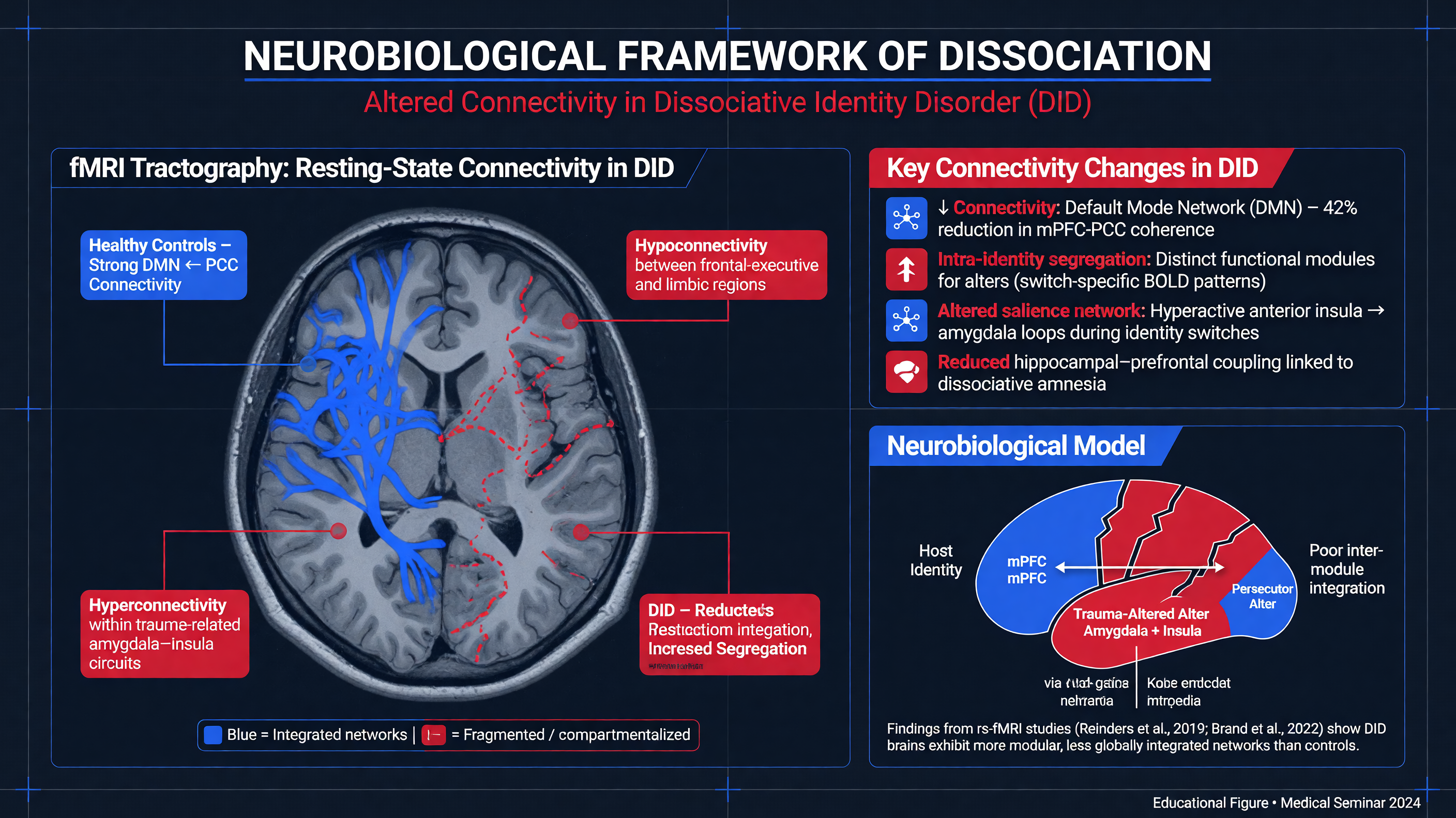 Brain scan highlighting altered connectivity in DID