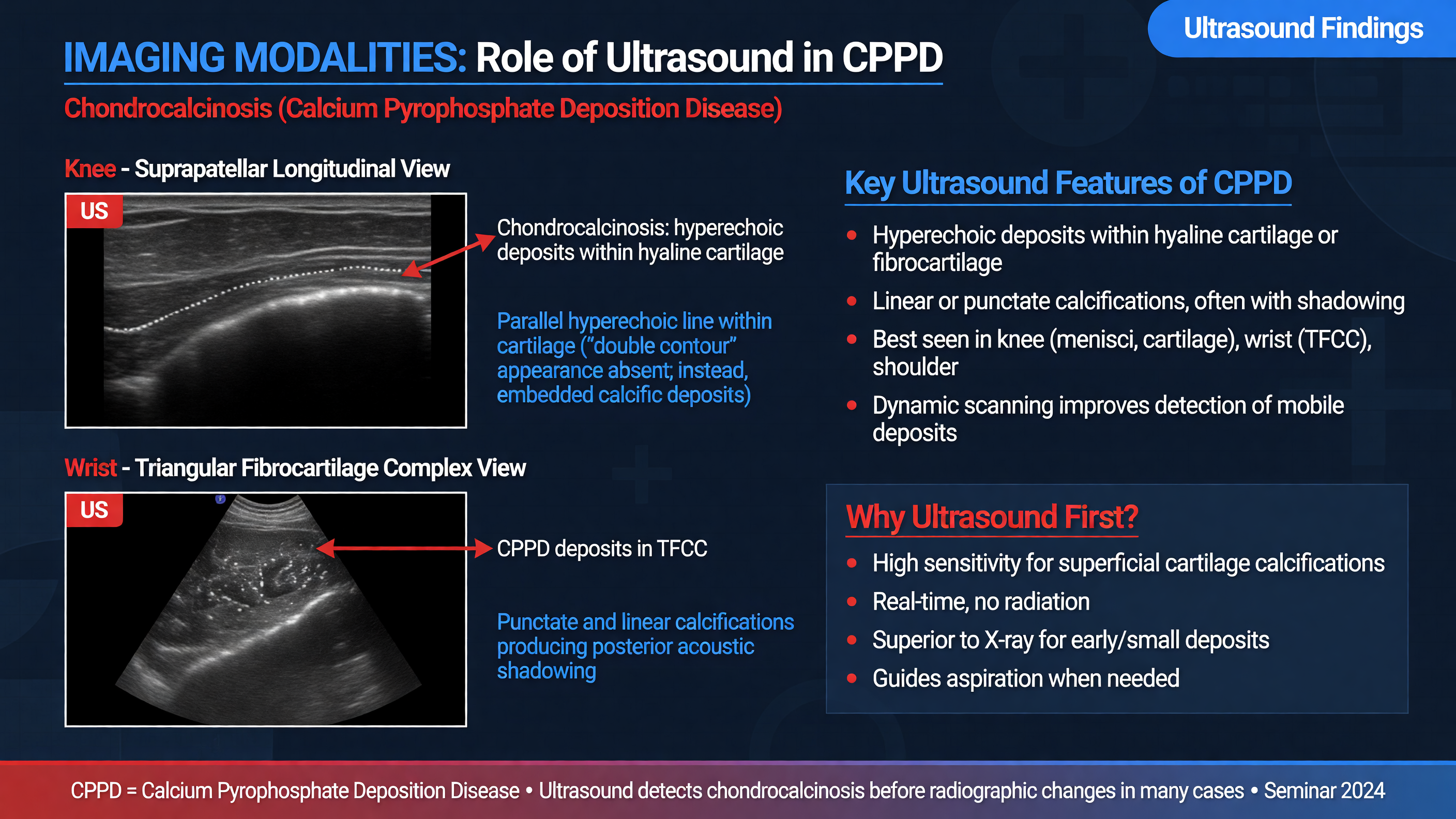 Ultrasound images showing chondrocalcinosis