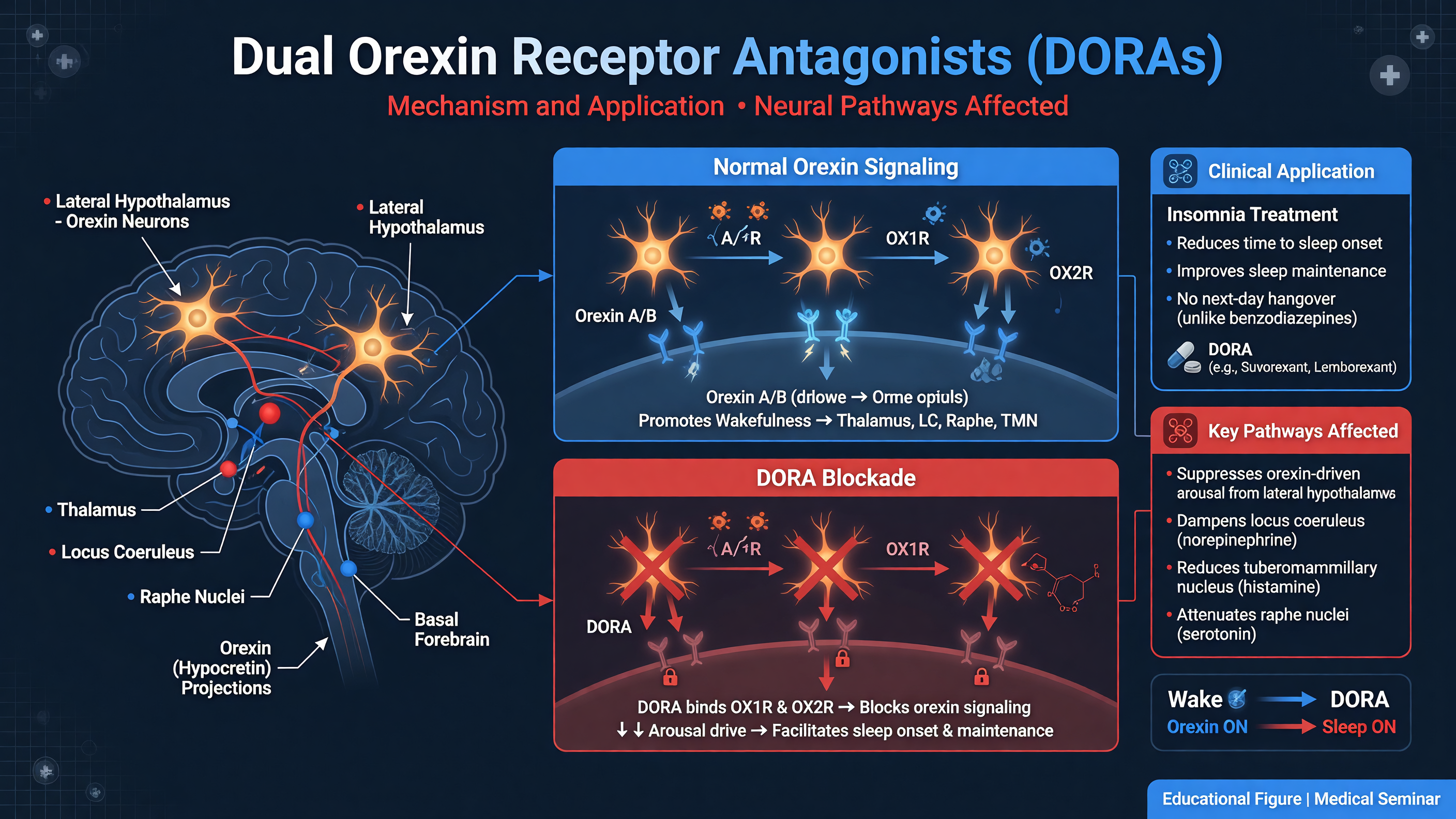 Illustration of neural pathways affected by DORAs