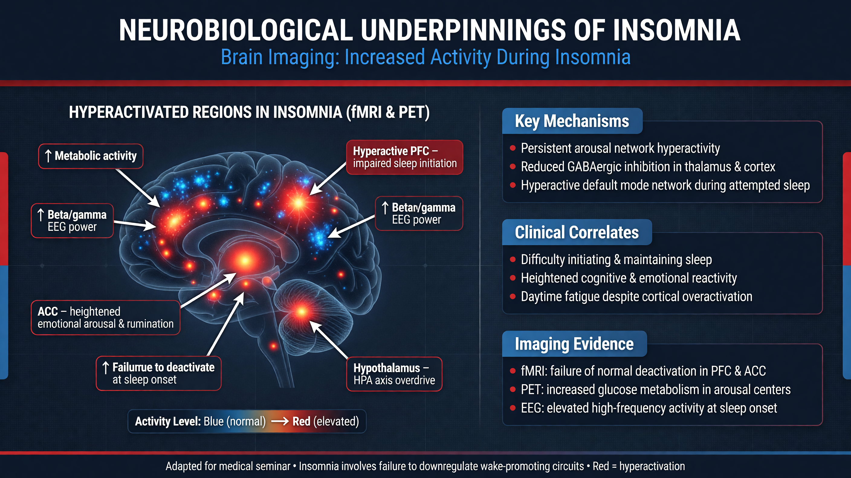 Brain imaging showing increased activity in insomnia