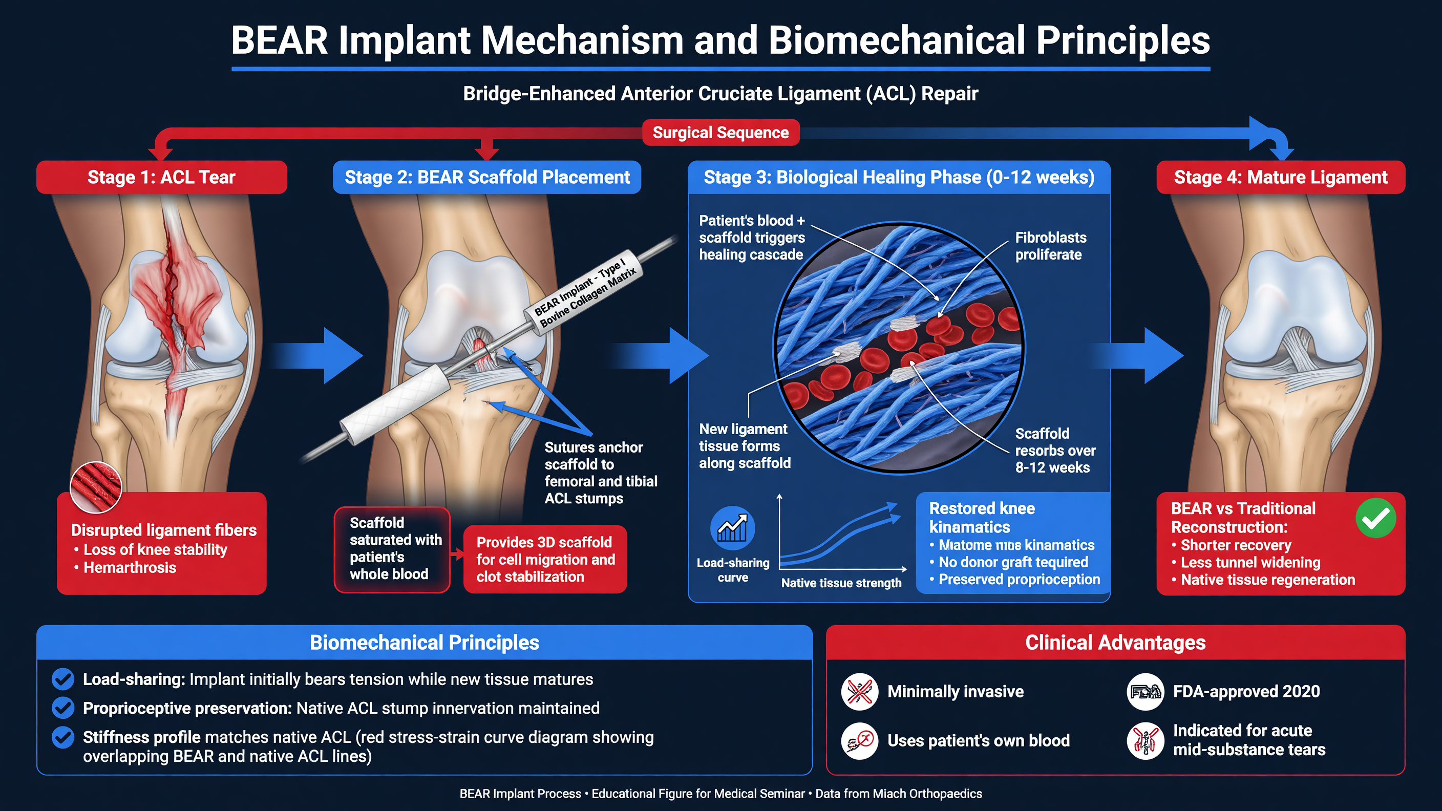 Diagram of BEAR implant process